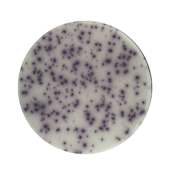 Well mit Spots eines EliSpot-Tests – T-Zell-Immunanalyse im ZAKlab